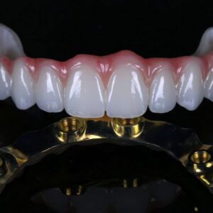 Full arch zirconia bridge for All-on-X case by China Dental Lab High precision custom titanium bar for All-on-4 implant restoration