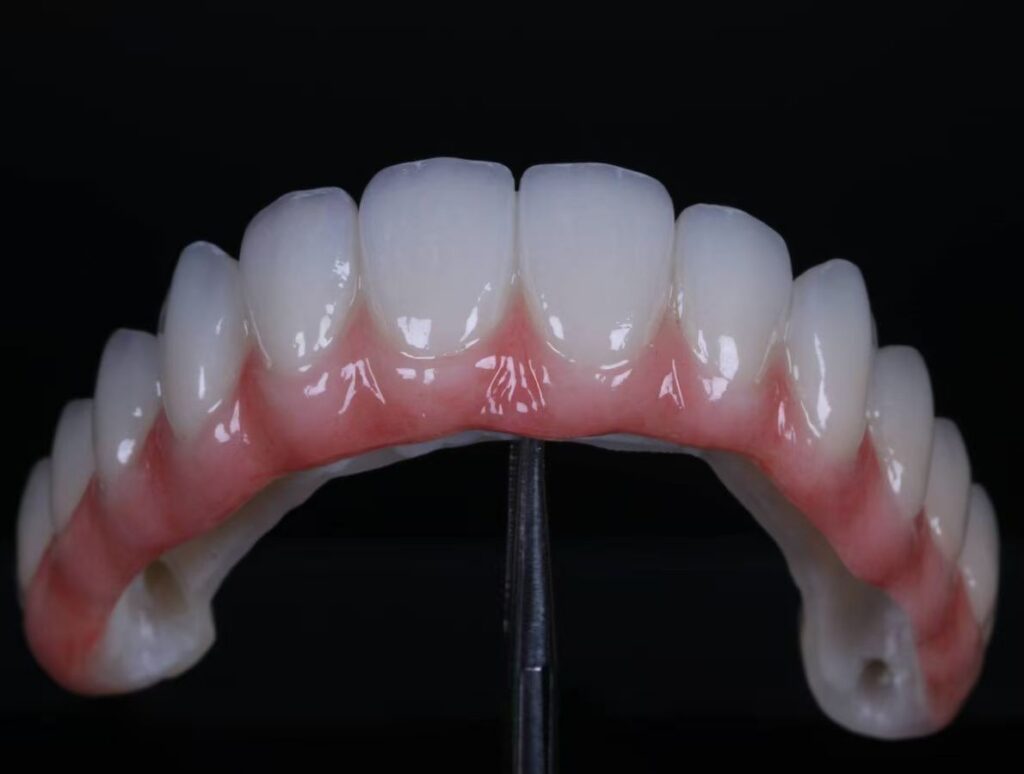 All on 4 All on 6 All on X Full Arch implant China Dental lab