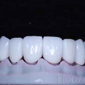 Zirconia crowns&bridge China dental lab
