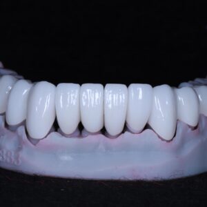 Zirconia Crowns China Dental Lab