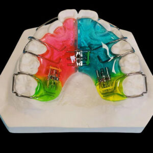 orthodontic_retainer China Dental Lab (1)
