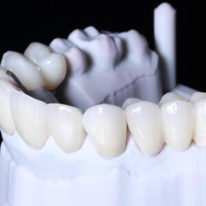 Zirconia Crowns&Bridge China Dental Lab
